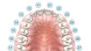 dental-zahnschema-FDI