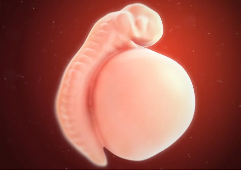 Embryo 3. SSW